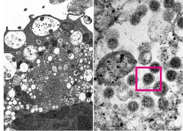 μεταλλαξη ομικρον