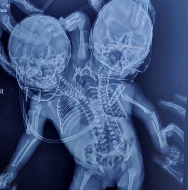 παιδιά ινδία