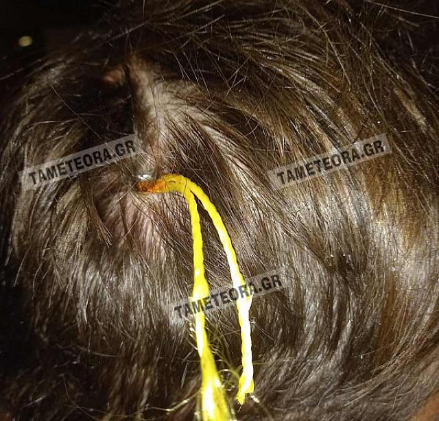 καρφί κεφάλι