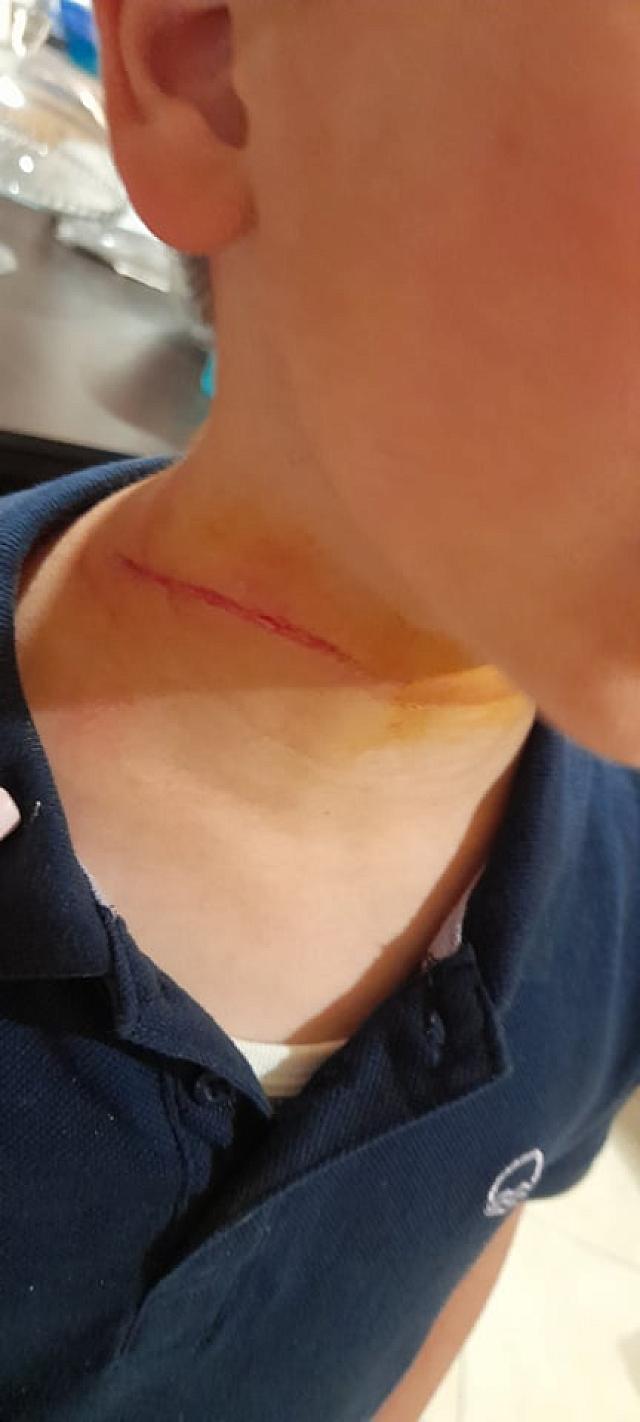 παιδί σκύλος