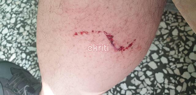 επίθεση σκύλου