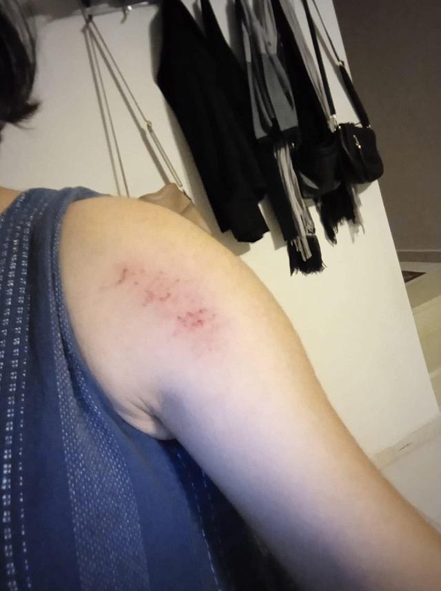 γυναίκα χαλάζι