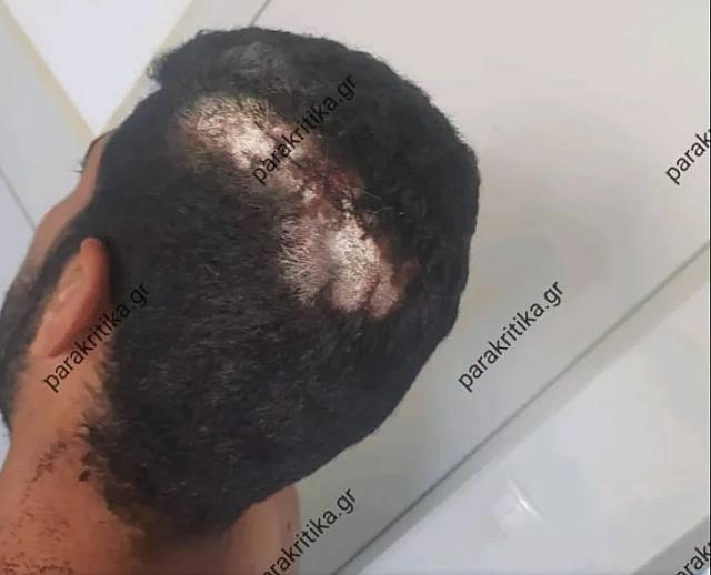 ξυλοδαρμός