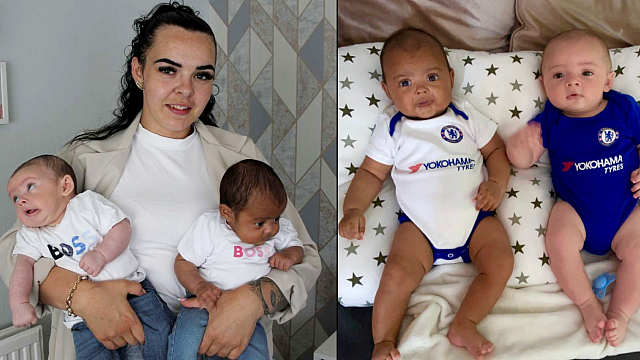 δίδυμα με διαφορετικό χρώμα δέρματος