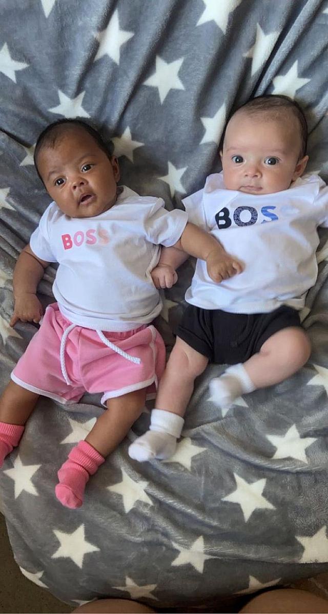 δίδυμα με διαφορετικό χρώμα δέρματος