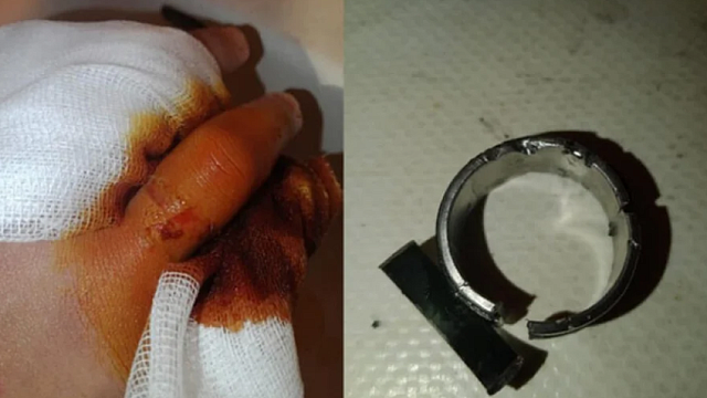 δαχτυλίδι πυροσβεστική