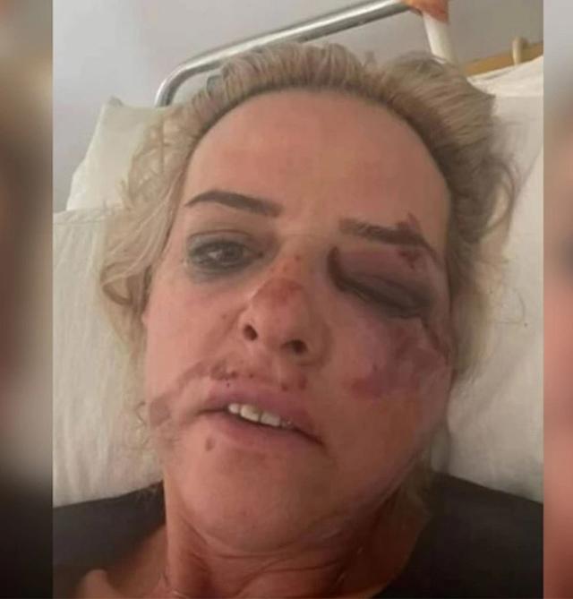 Καλαμάτα - 45χρονη