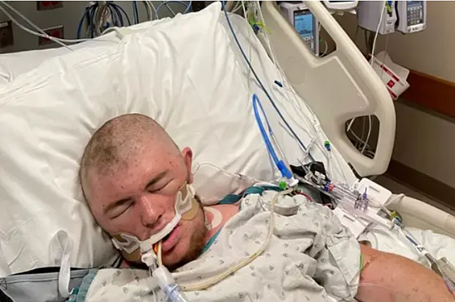 μέλισσες ΗΠΑ