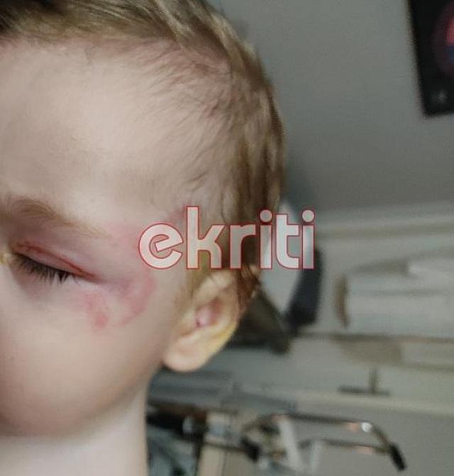 παιδί σκύλος αμμουδάρα