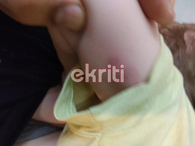 παιδί σκύλος αμμουδάρα