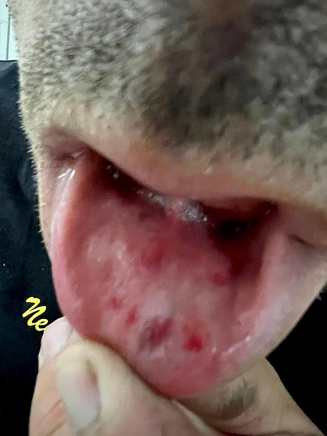 Τραυματα - Αστυνομικός