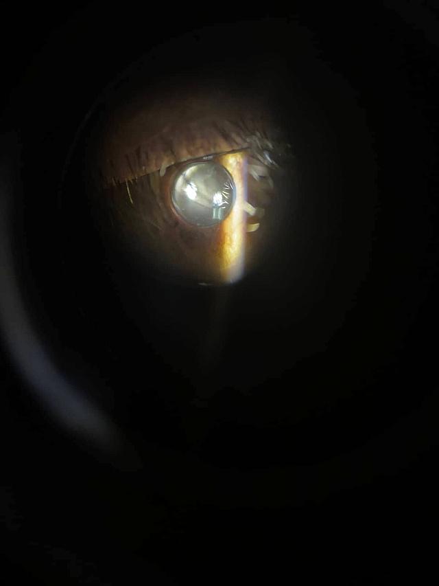 Τοποθέτηση Ενθέματος