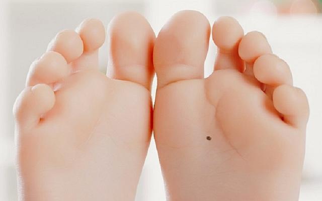 ελιά στην πατούσα