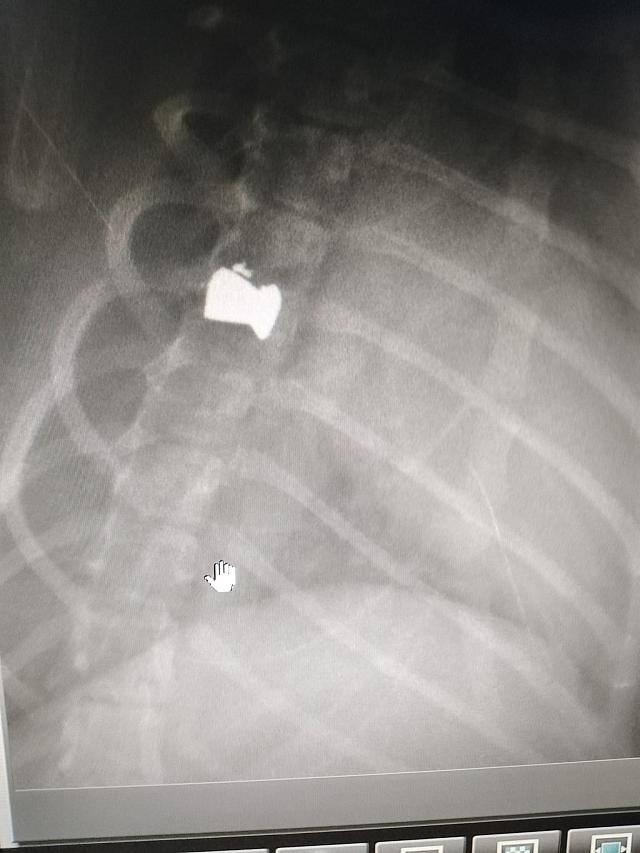 ακτινογραφια