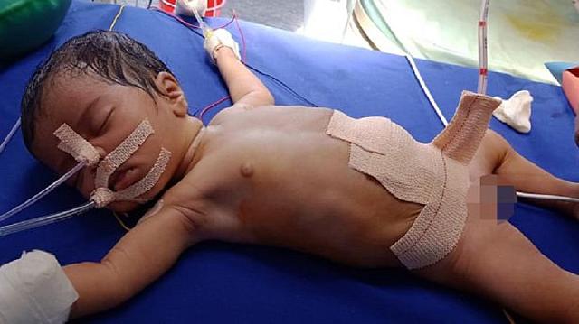 κοριτσάκι Ινδία