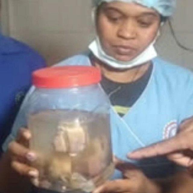 έμβρυα Ινδία