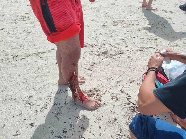 επιχείρηση μπάλος