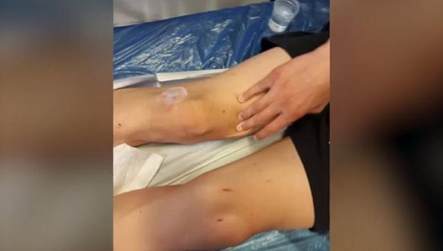 καλαματα ξυλοδαρμος