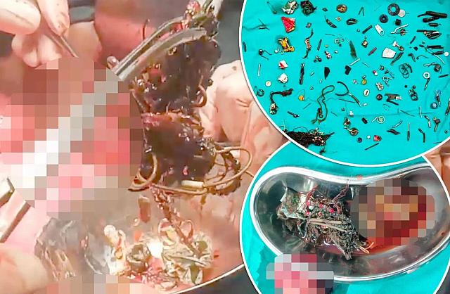 ασθενής στομάχι