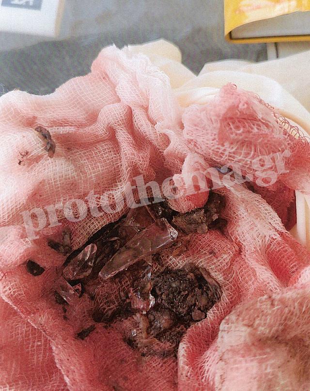 σκύλος - φόλα