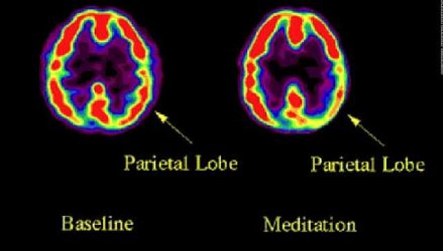 ΔΙΑΛΟΓΙΣΜΟΣ