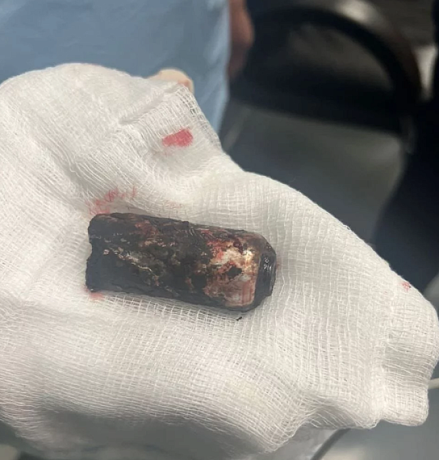 φωτοβολίδα επεισόδια Ρέντη