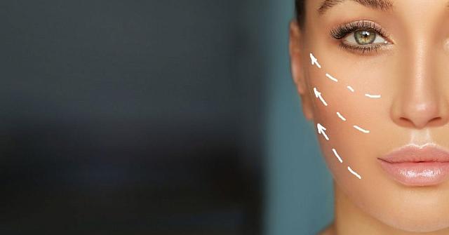 υαλουρονικό