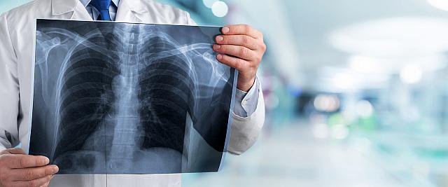 Ακτινογραφία