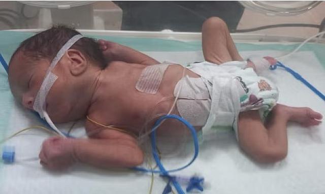 προωρο μωρό Γάζα