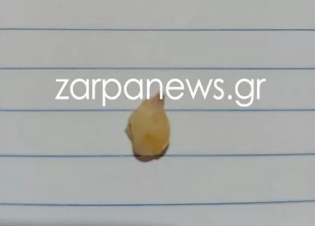 δοντι σε γκοφρετα