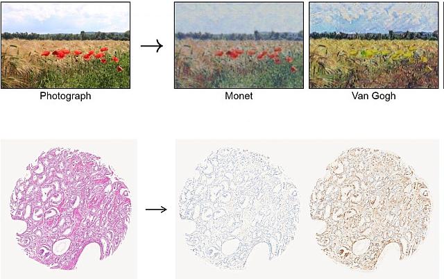 μοντέλο καρκίνος