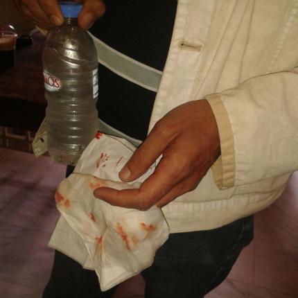 Η Δημοτική Παράταξη "Άμεση Δημοκρατία" καταδικάζει επεισόδια στο Ειρηνοδικείο Ηρακλείου