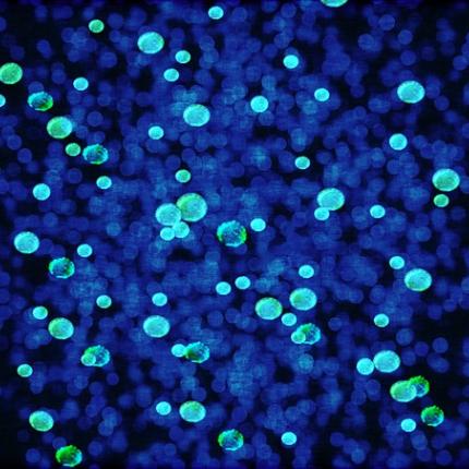 Candida auris...η νέα απειλή για την ανθρωπότητα 