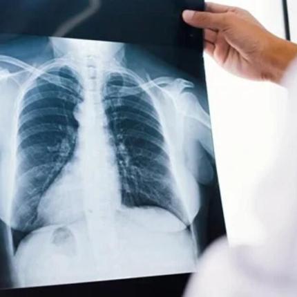 Γιατί ένα μεγάλο ποσοστό διαγιγνώσκονται σε προχωρημενο σταδιο 