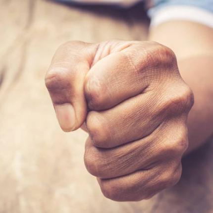 ξυλοδαρμος