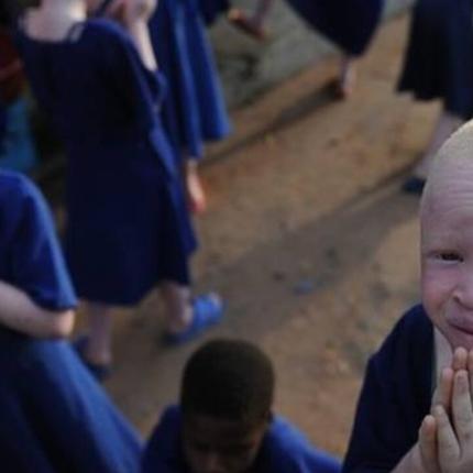 Δολοφόνησε τον Αλμπίνο αδερφό του και πούλησε τα μέλη του σώματος του