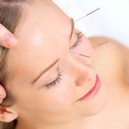 βελονισμός