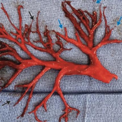 ιατρικό εύρημα