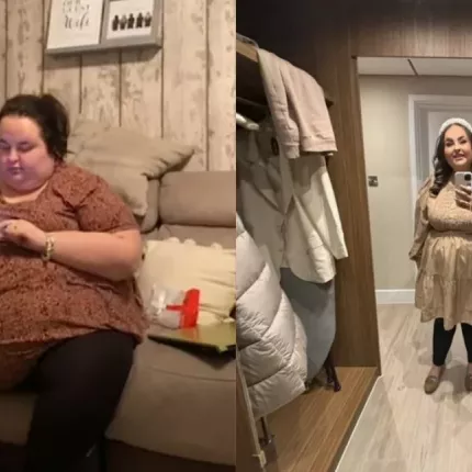 παχυσαρκία γυναίκα πριν μετά