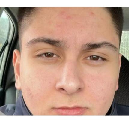 Μιχάλης - Τροχαίο Γκαγκάλες