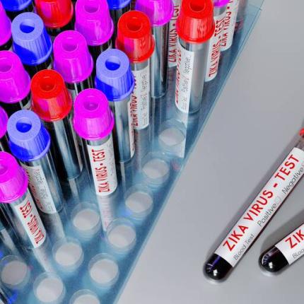 εξετάσεις αίματος