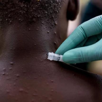 ΕΥΛΟΓΙΑ ΠΙΘΗΚΩΝ