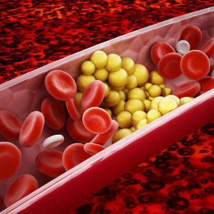 Χοληστερόλη