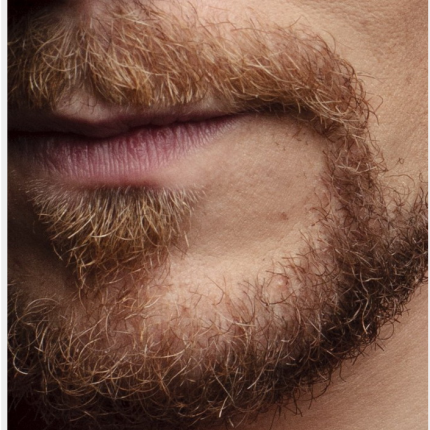 Ομογενής προσέφυγε στο Ανώτατο Δικαστήριο για... τις τρίχες του