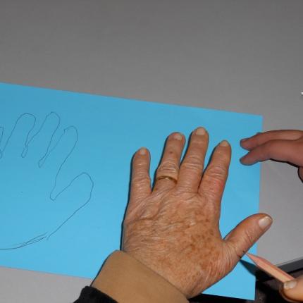 αλτσχάιμερ