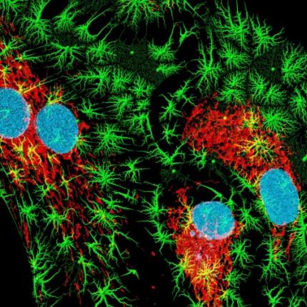 Νόμπελ Χημείας για την ανάπτυξη μικροσκοπίας φθορισμού 