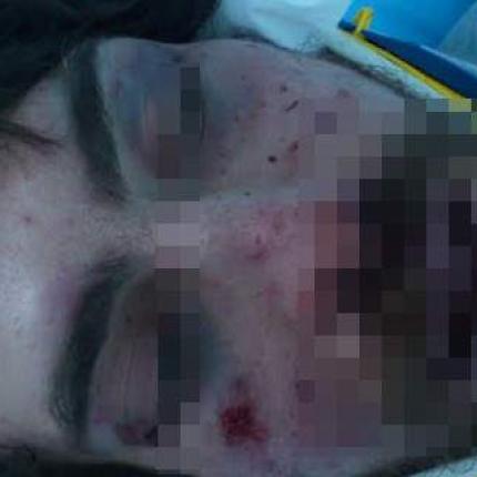 φοιτητής ξυλοδαρμός