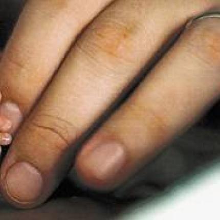 Συρία: Γλίτωσε δύο φορές από το θάνατο και γέννησε πεντάδυμα