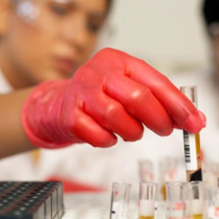 Πρωτιά Ελληνίδας ερευνήτριας στον αγώνα κατά του AIDS