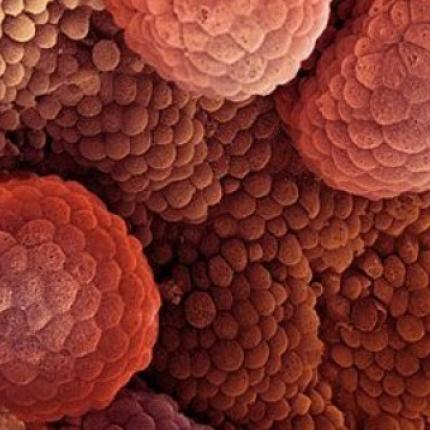 Ο καρκίνος «προτιμά» τέσσερις νομούς της Μακεδονίας